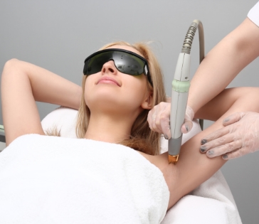 Laser Hair Removal