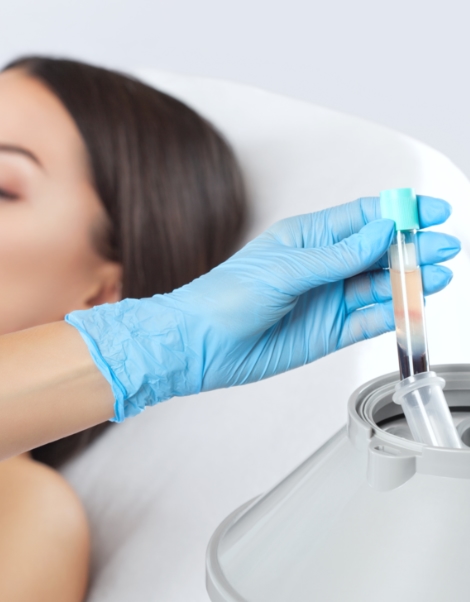 Microneedling & PRP