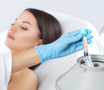 Microneedling & PRP